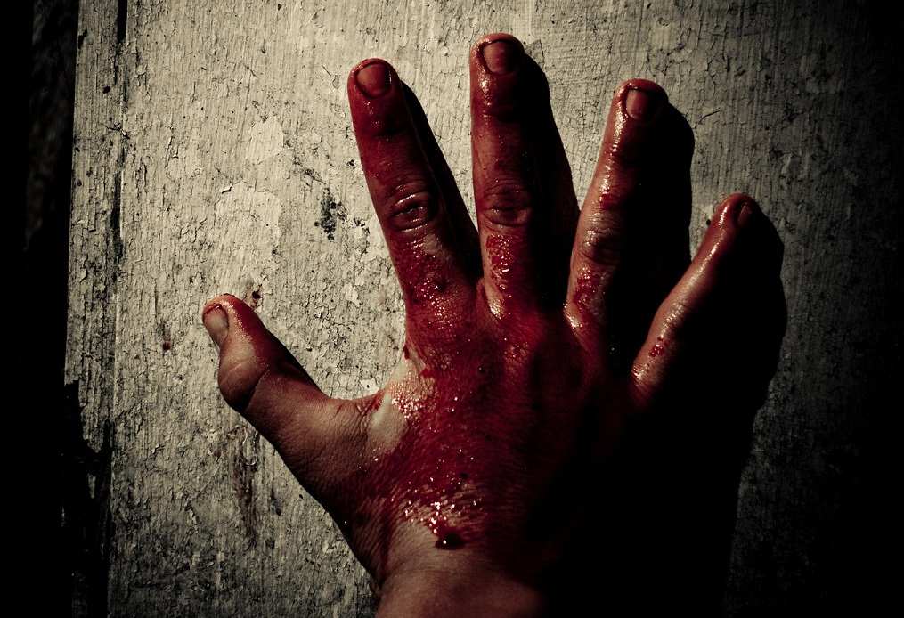 В Днепропетровске граната взорвалась в руках 15-летнего парня (ВИДЕО) | Русская весна