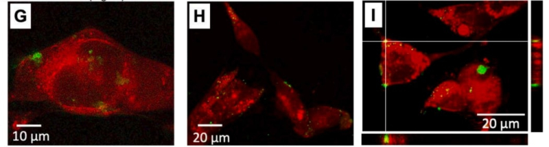 Исследование токсичности наночастиц MOFs, конъюгированных с флуоресцентным красителем (помечены зеленым цветом), на клетках мышиной меланомы (помечены красным цветом). Изображения были получены с помощью конфокальной лазерной сканирующей микроскопии.Изображение предоставлено Ириной Корякиной. 