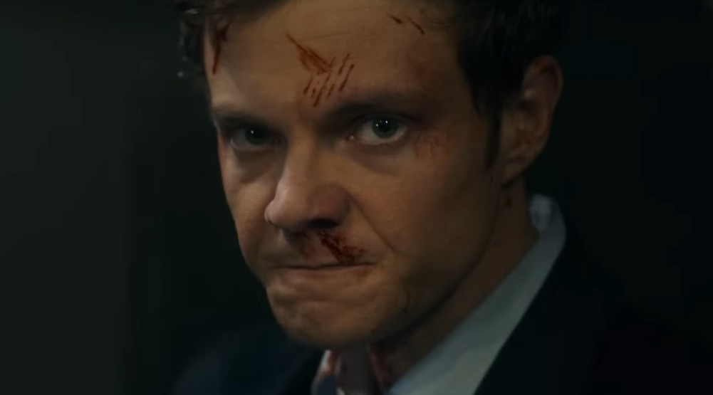 Кадр из фильма «Новокаин» (2025)