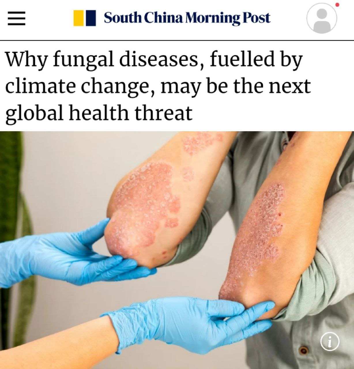 Человечество убьют не вирусы и бактерии, а вышедшие из-под контроля грибковые инфекции | Русская весна