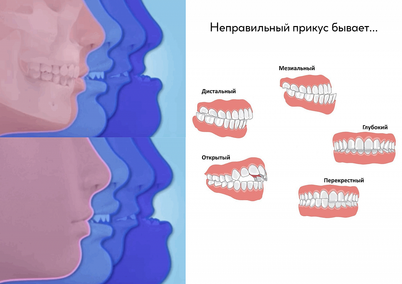 описание улыбки в фанфике фото 12