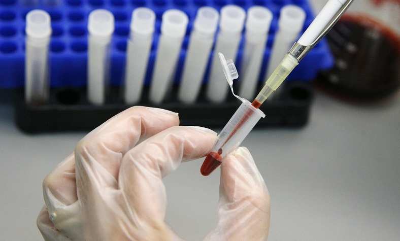 СМИ рассказали о неочевидном признаке смертельного заболевания