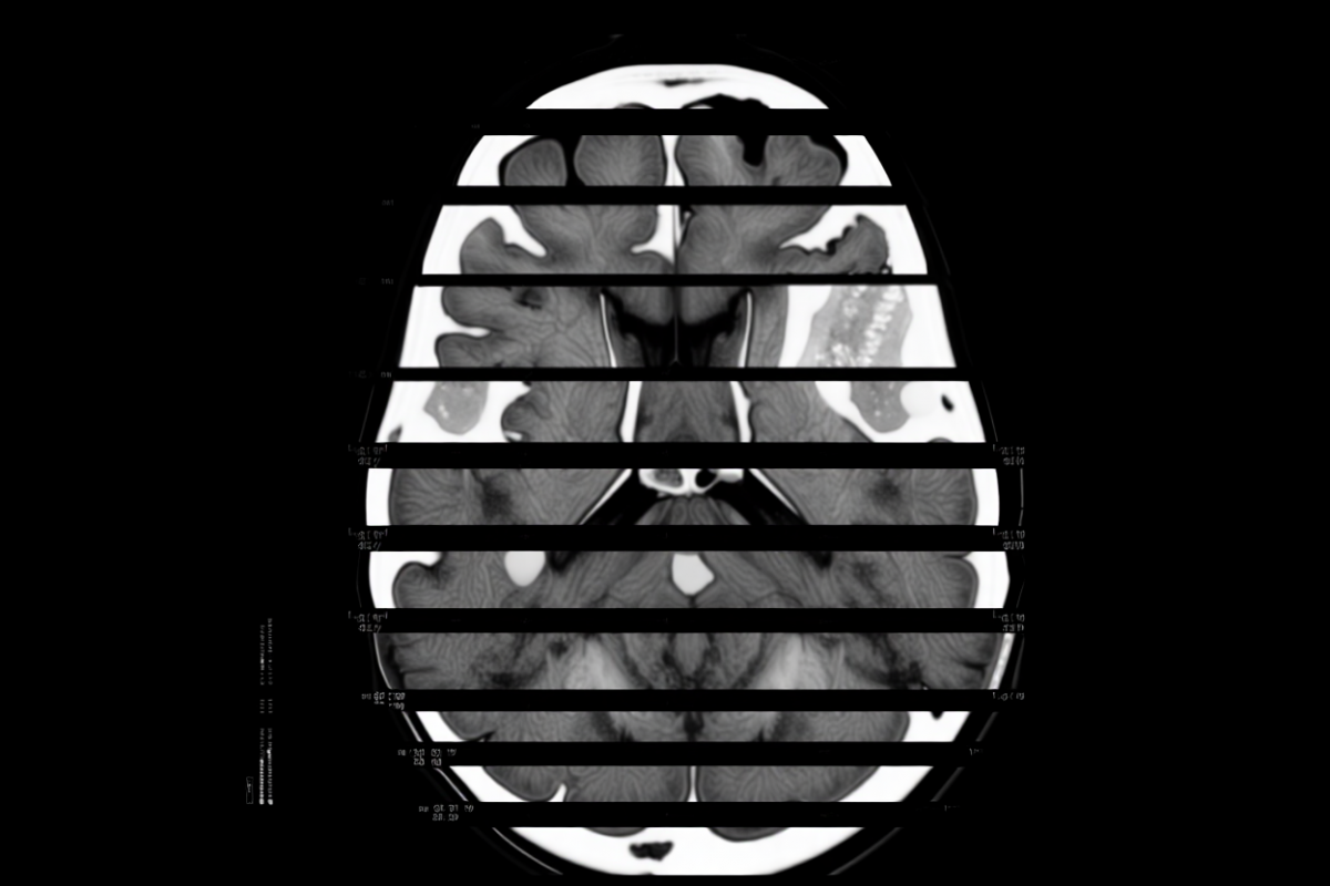 В России разработали ИИ для раннего выявления деменции по КТ