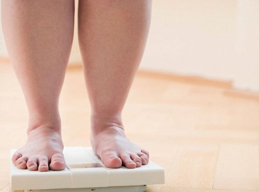 Ноги у толстых людей. Лишний вес у детей. Избыточный вес. Ноги с избыточным весом.
