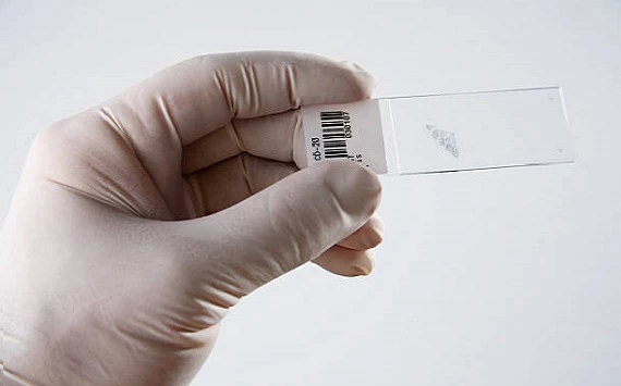 Ученые из трех питерских научных школ создали инновационную технологию выявления радикалов