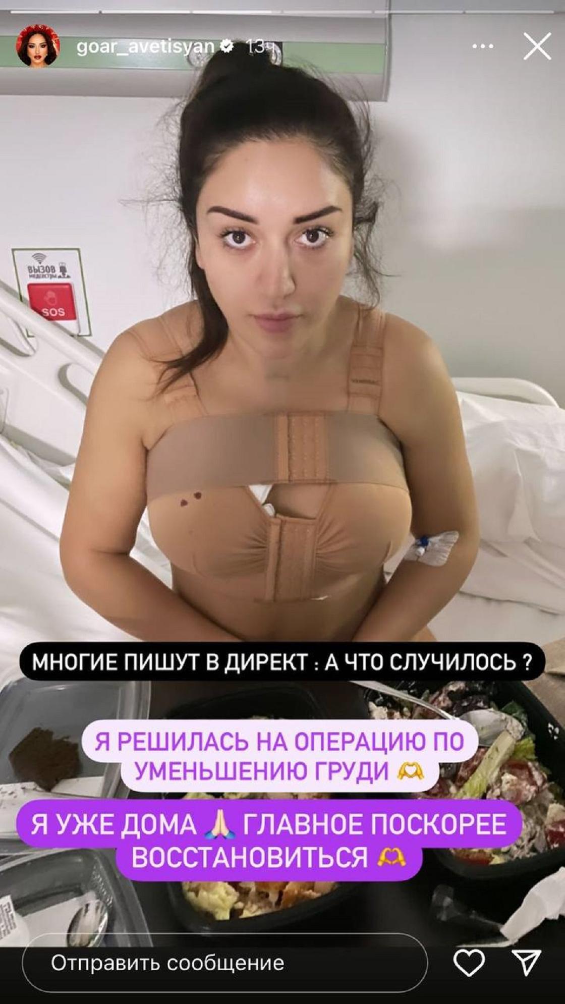 как делают пластическую операцию груди женщин фото 48