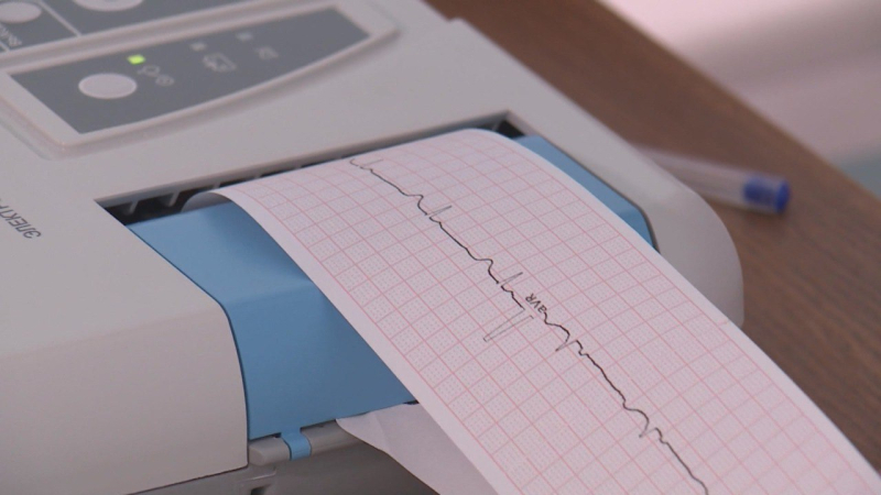 Костромские врачи смогут расшифровывать данные электрокардиографии дистанционно