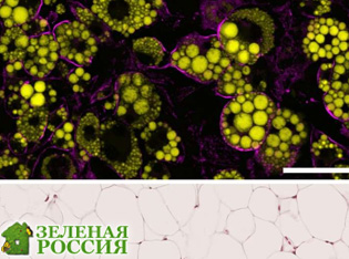 Жировые клетки защищают организм от избытка энергии