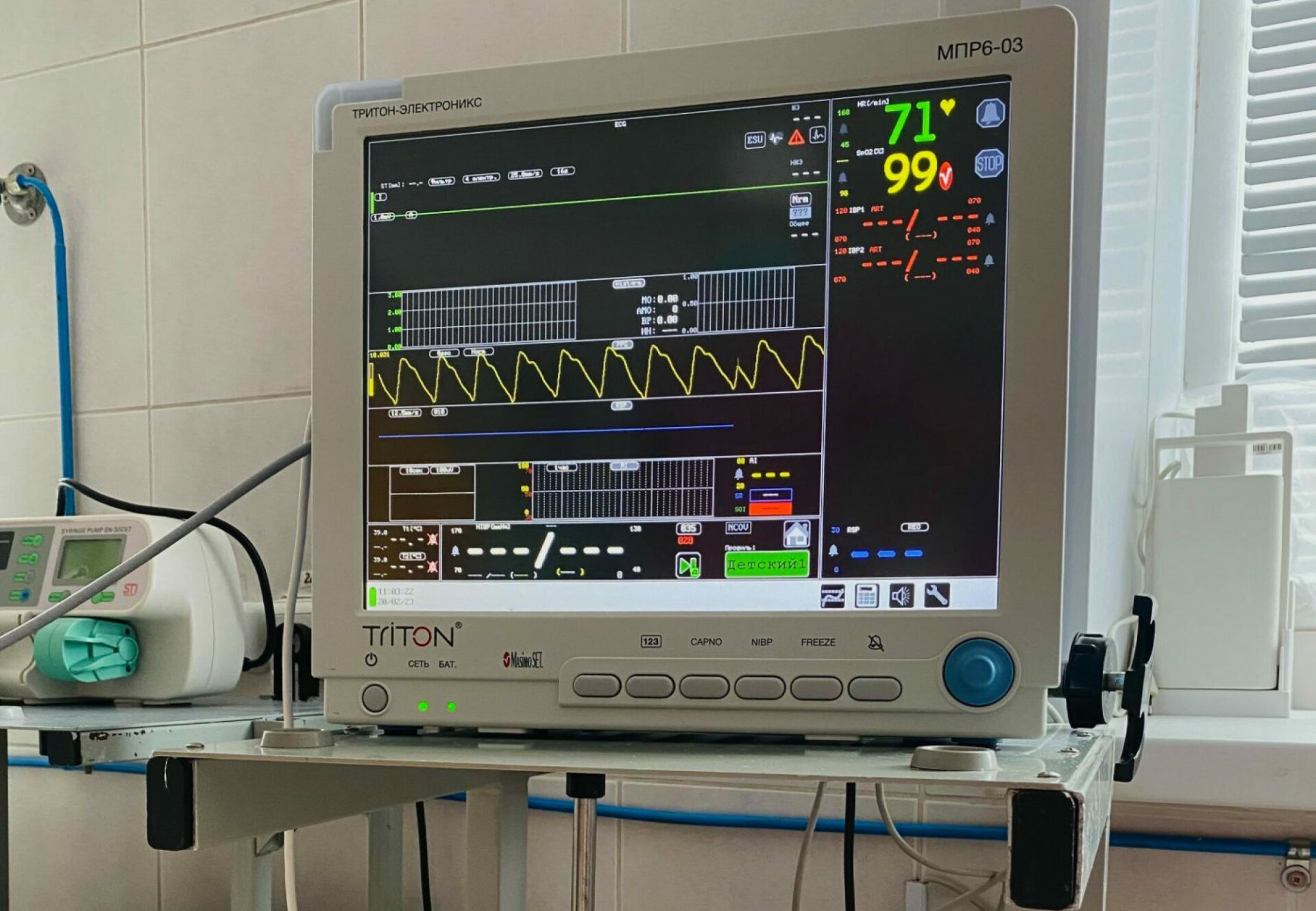 монитор прикроватный реаниматолога и анестезиолога окоф