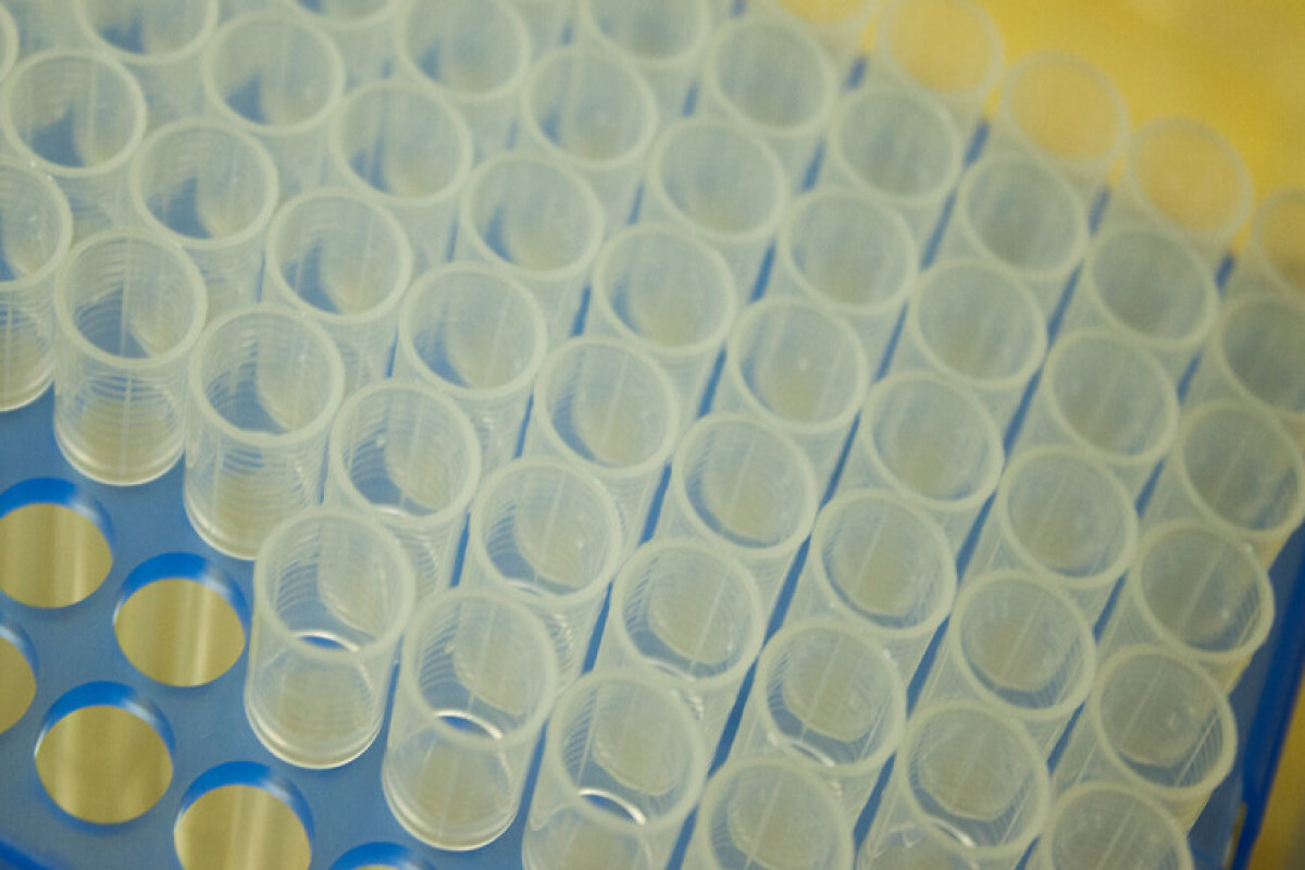 ростов проб. витраж туберкулиноаой пробы. проба с инсулином на гормон роста у детей. магазин 585 в ростове. космонавтов 2/2 тц вавилон.