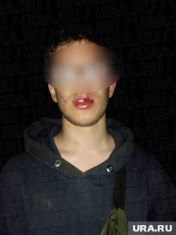 Подростку рассекли губу