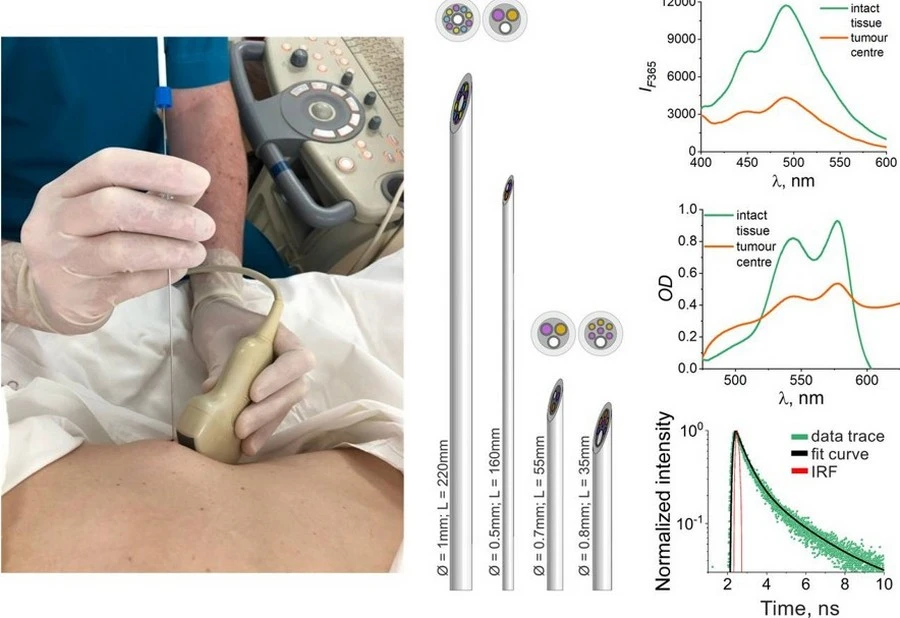 Орловские учёные разработали технологию оптической биопсии для мгновенного распознавания рака