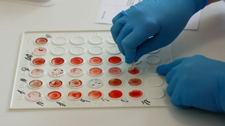 К чему снится кровь: значение, толкование по соннику Миллера и Цветкова