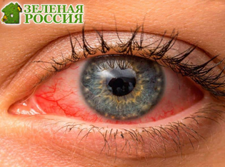 Обычные глазные мази могут вызывать отёк и разрыв имплантов при глаукоме