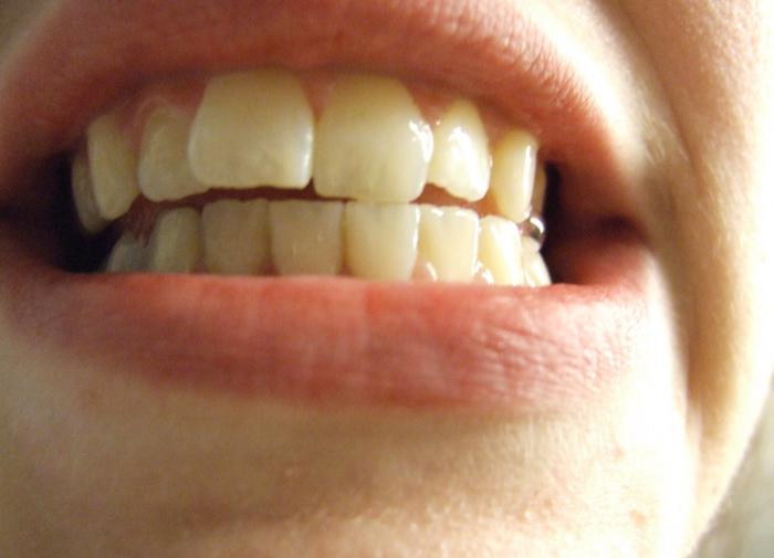 Стоматолог Насыров заявил, что по улыбке можно определять проблемы со здоровьем