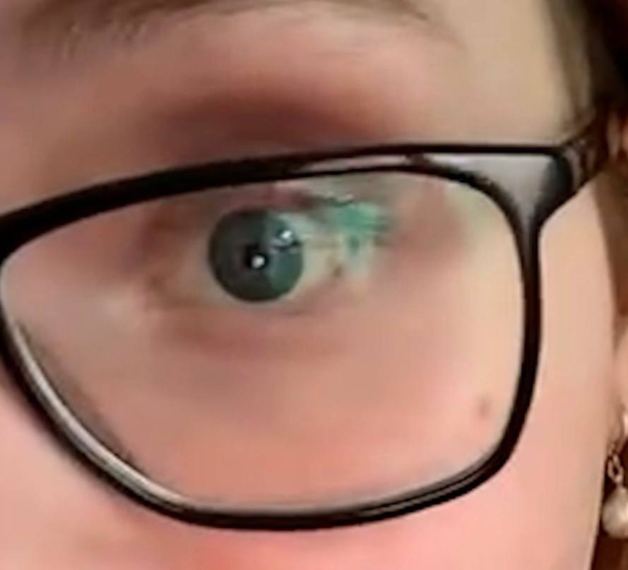 Девушка лишилась зрения