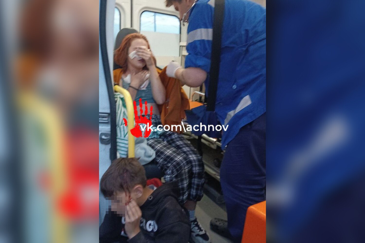Брызнули перцовым баллончиком в лицо карта вызова