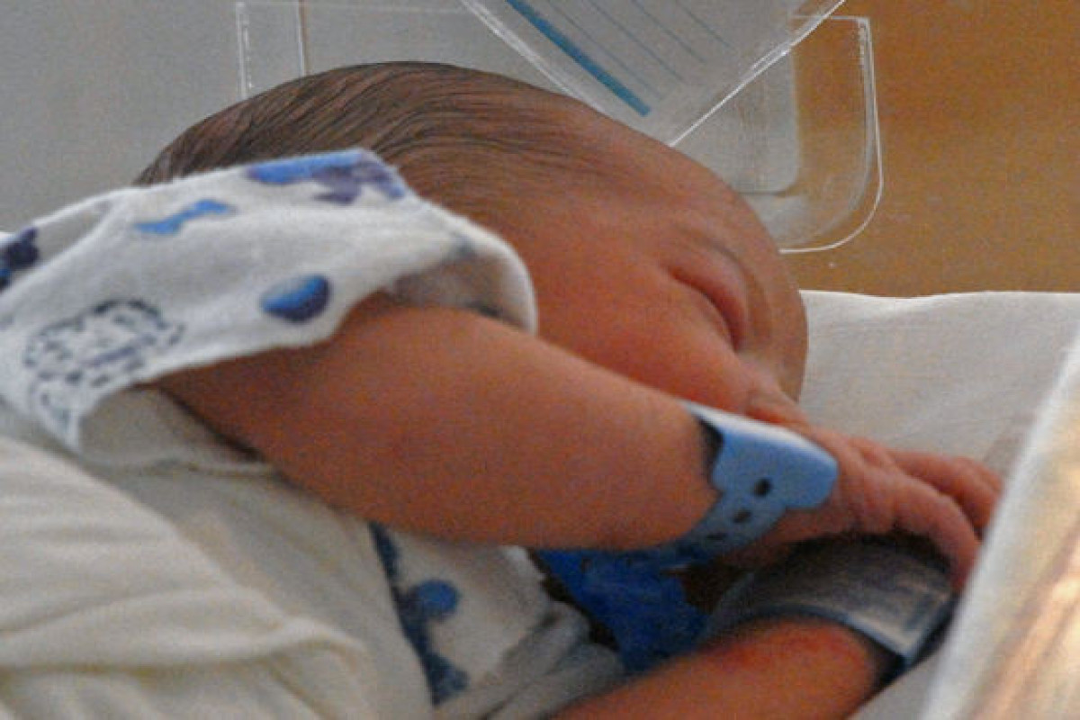 Половые органы новорожденного мальчика. Родился гермафродит ребёнок. Двуполость у детей фото.