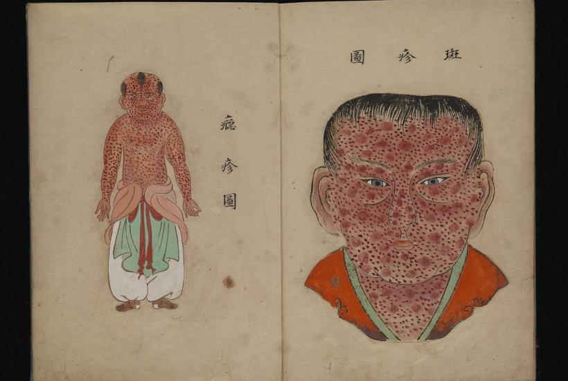 Иллюстрация к истории об оспе, японская рукопись, ок. 1720
