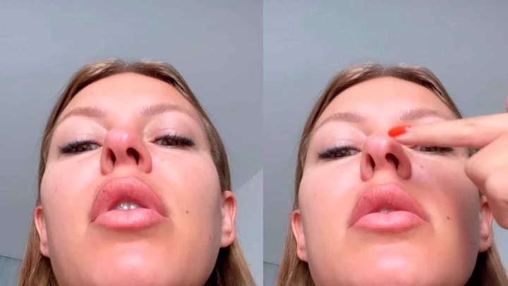 Рита дакота до и после пластики