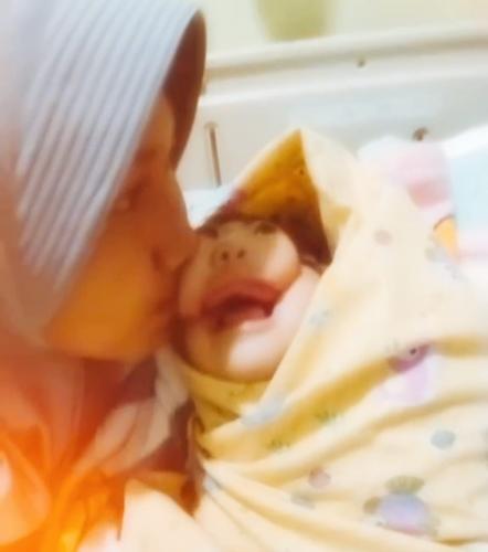 В Узбекистане массово рождаются дети-мутанты