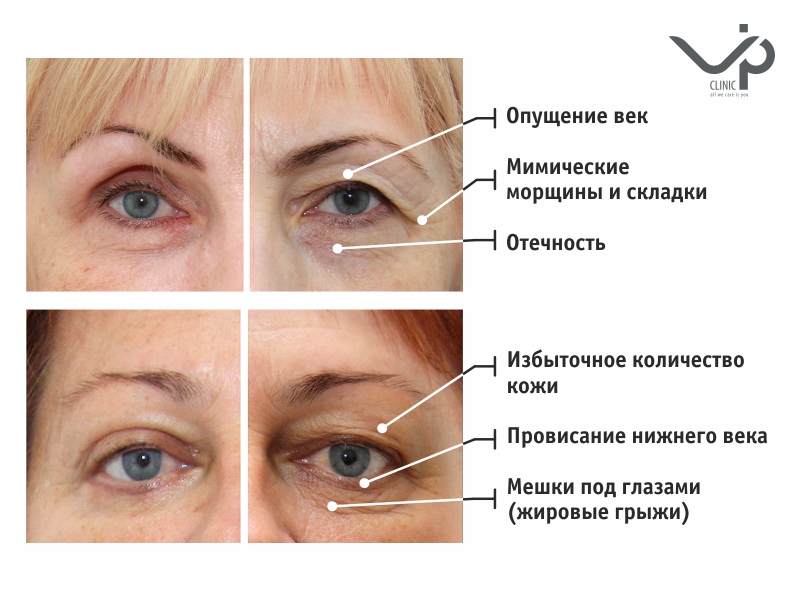 3 VIP clinic before after 800х600