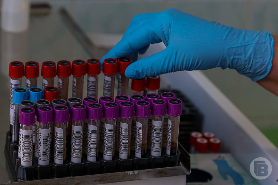 Волгоградцы смогут бесплатно пройти тест на ВИЧ в День борьбы со СПИДом