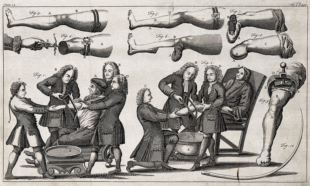 Раненых солдат ВСУ косит гангрена: все хуже, чем в Первую и Вторую мировые 