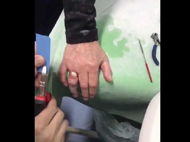 Как можно снять кольцо с опухшего
