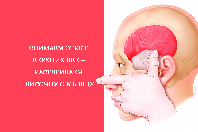опухоль бластома головного мозга лобной доли. височная припухлость. височная припухлость. припухлость на лице около носа. опухоль височной доли симптомы.