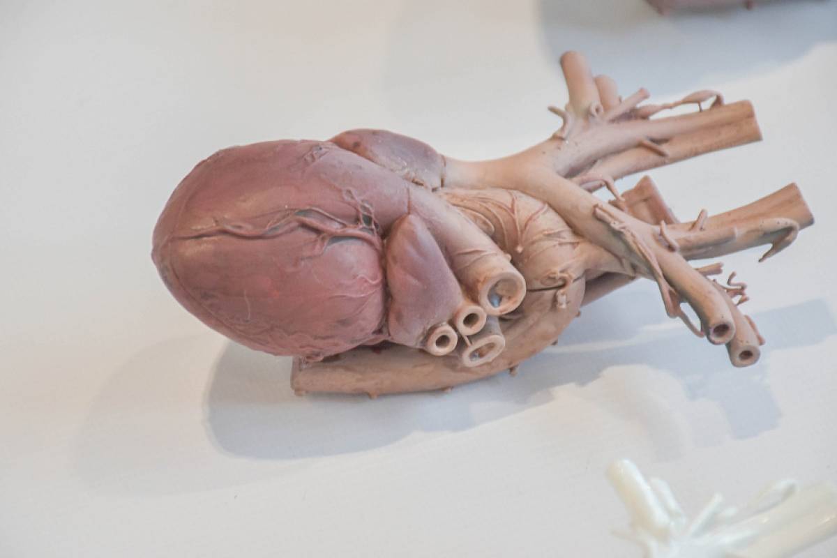 Специалисты компании «Анатомическое проектирование» производят анатомически верные копии ключевых органов и костных тканей человека.