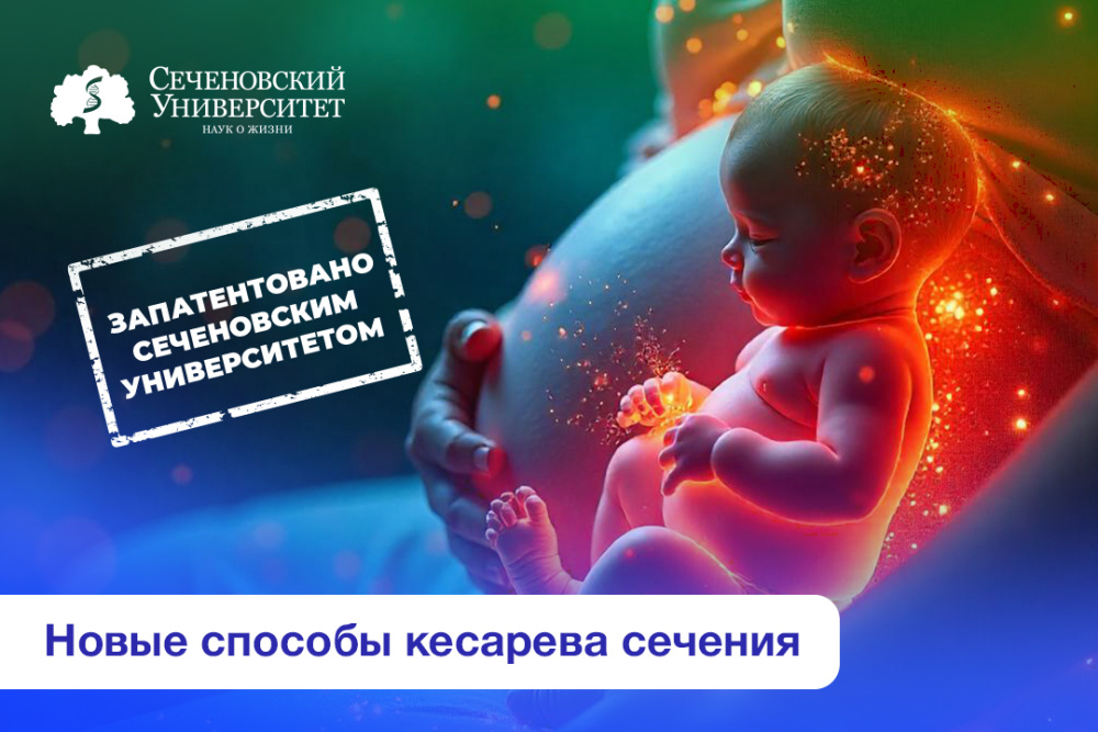  В Сеченовском Университете продолжают искать способы кесарева сечения, которые могут увеличить число естественных родов после операции 