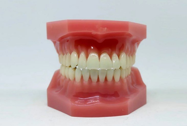 Стоматолог Яворовская назвала причины образования щели между зубами