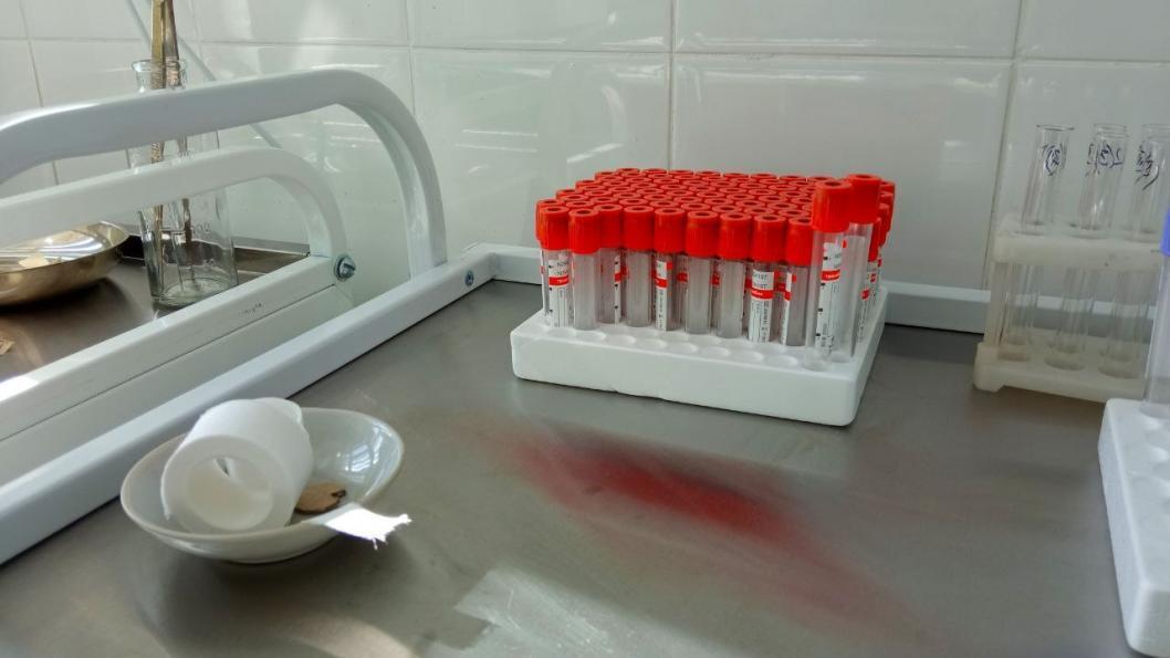 Лаборатория тест экспресс. Лабораторные тесты на ВИЧ. Виды лабораторий крови. Организация экспресс лаборатории. Лаборатория сдачи крови в Березниках.