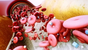 Доказано: высокий уровень сахара после приема пищи опасен даже для здоровых людей