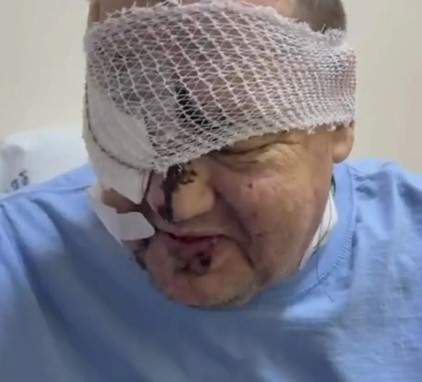 Переживший атаку дрона ВСУ отец Евгений из Суджи записал видео из больницы