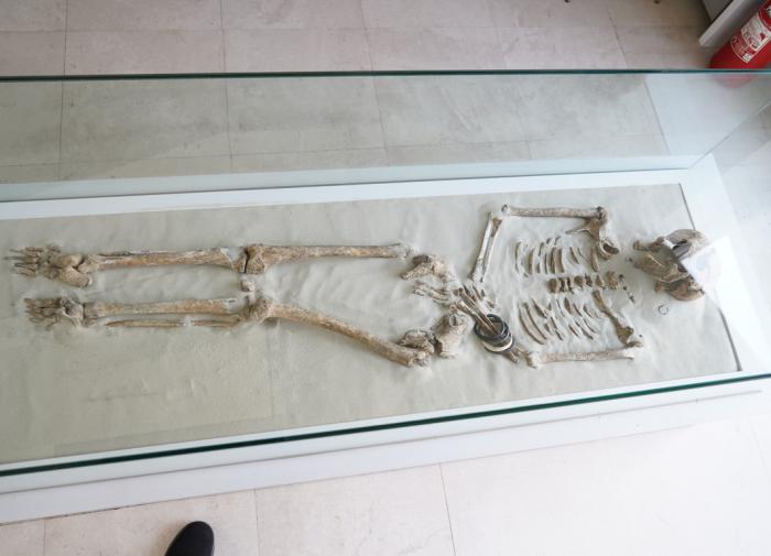 В Перми разработали систему для регенерации человеческих костей