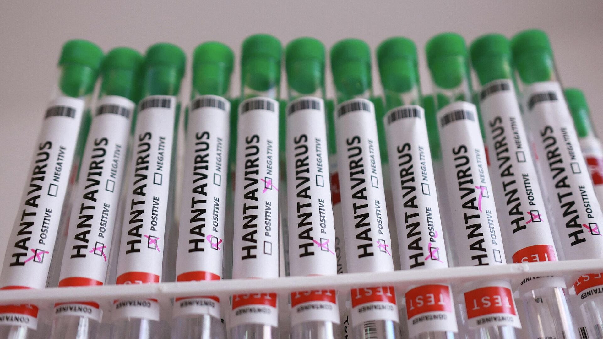 Роспотребнадзор назвал источники хантавирусной инфекции для человека