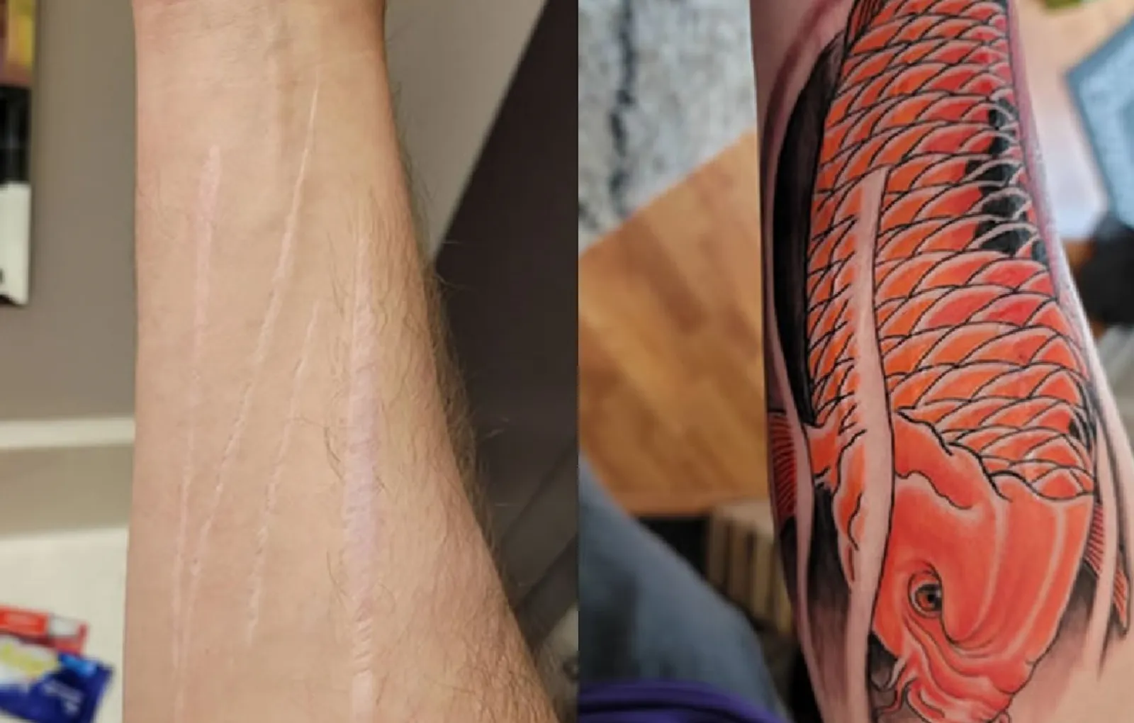Как выглядит шрам на руке 10+ abrupt tattoos which ideally hid ugly scars Lifestyle Seldon News