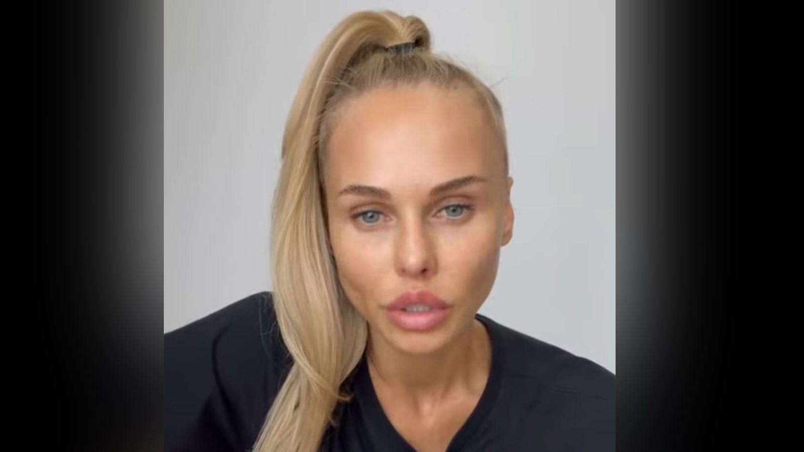 Надежда санько фото до пластики