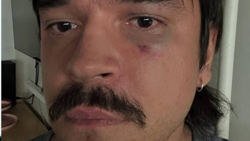 Дизайнера Никиту Калмыкова избили неизвестные