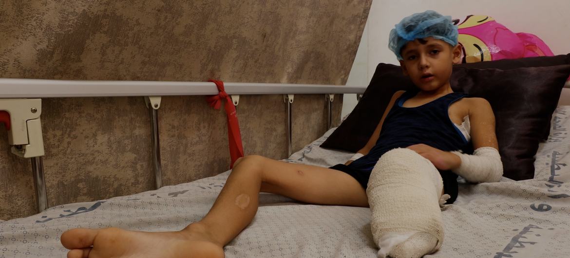 Мальчик в Газе потерял ногу в результате авиаудара.