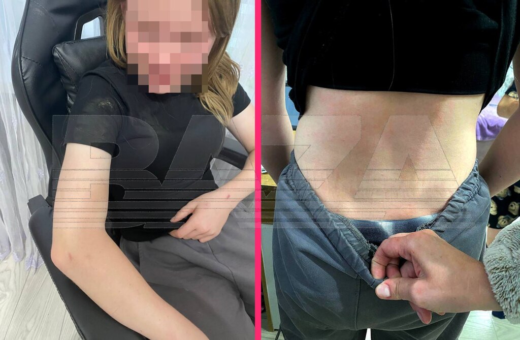 После жестокого избиения 12-летней школьницы. Фото: Baza