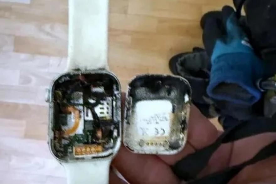 В челябинской школе на уроке вспыхнули смарт-часы ученика