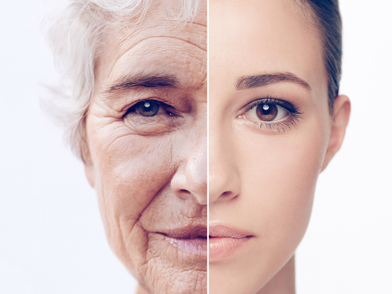 Skin aging