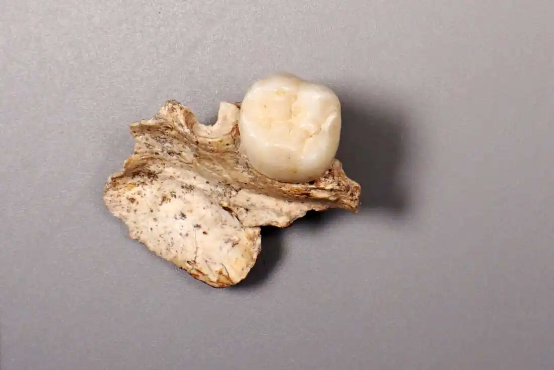 Денисовцы и Homo erectus могли скрещиваться, показало исследование ископаемых зубов
