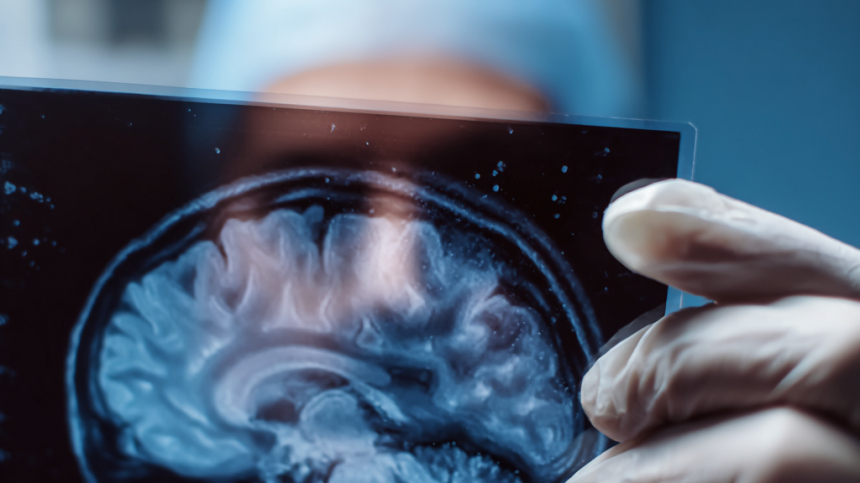 Симптомы заболевания мозга