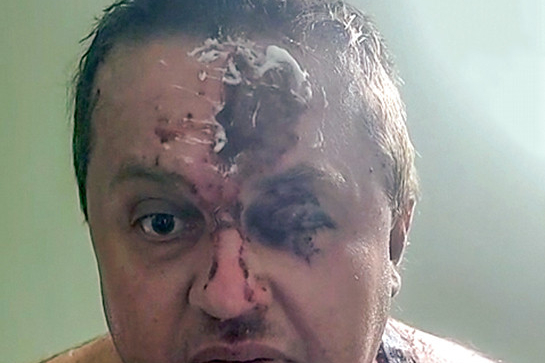 Игорь Ронжин сразу после нападения на него.