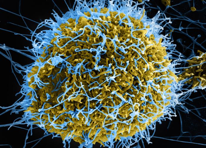 Врач Аграновский заявил, что Alaskapox не угрожает эпидемией