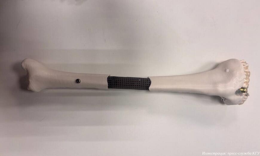 Ученые КГУ и Центра Илизарова создали модульные костные имплантаты